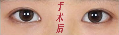 ۽ֽϺ