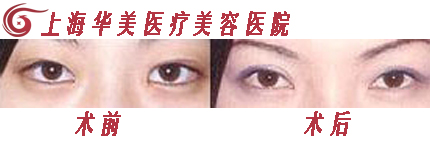 ۽ǰԱͼ