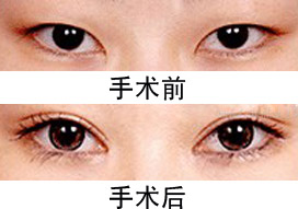  ˫ƤǰԱͼ