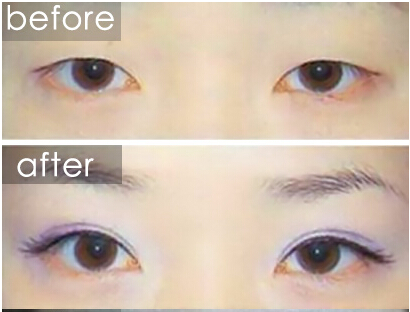 ˫ƤǰԱͼ